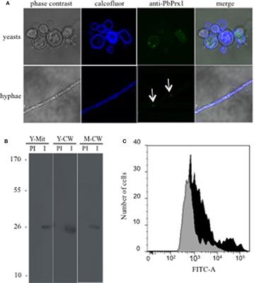 The Human Pathogen Paracoccidioides brasiliensis Has a Unique 1-Cys Peroxiredoxin That Localizes Both Intracellularly and at the Cell Surface